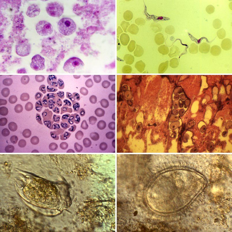 Protozoa Protozoa and amoebae are found in water-damaged buildings